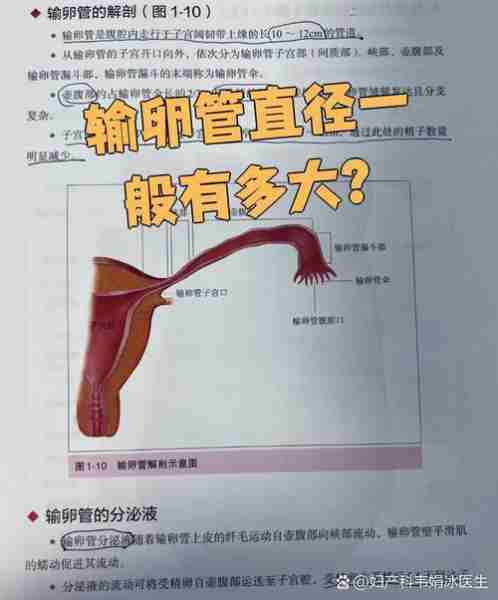 输输道解管道术析（输卵管解剖位置示意图）